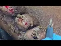 FREE JIGGER Sikuku s final dejiggering see such vids riseupsociety net ruskenya org