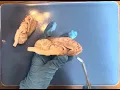Sheep Brain Dissection A P
