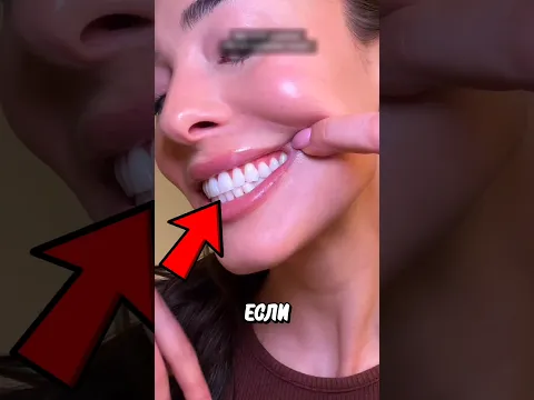 Как Отбелить Зубы? 🤯