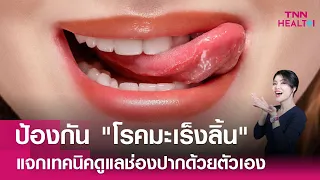 การใช้น้ำยาบ้วนปากชนิดใดเหมาะกับผู้ป่วยมะเร็งที่มีปัญหาช่องปาก