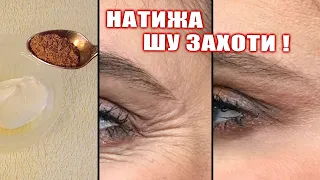 ЮЗИНГИЗГА СУРИНГ АЖИНЛАР ЙУКОЛАДИ. НАТИЖА ШУ ЗАХОТИ