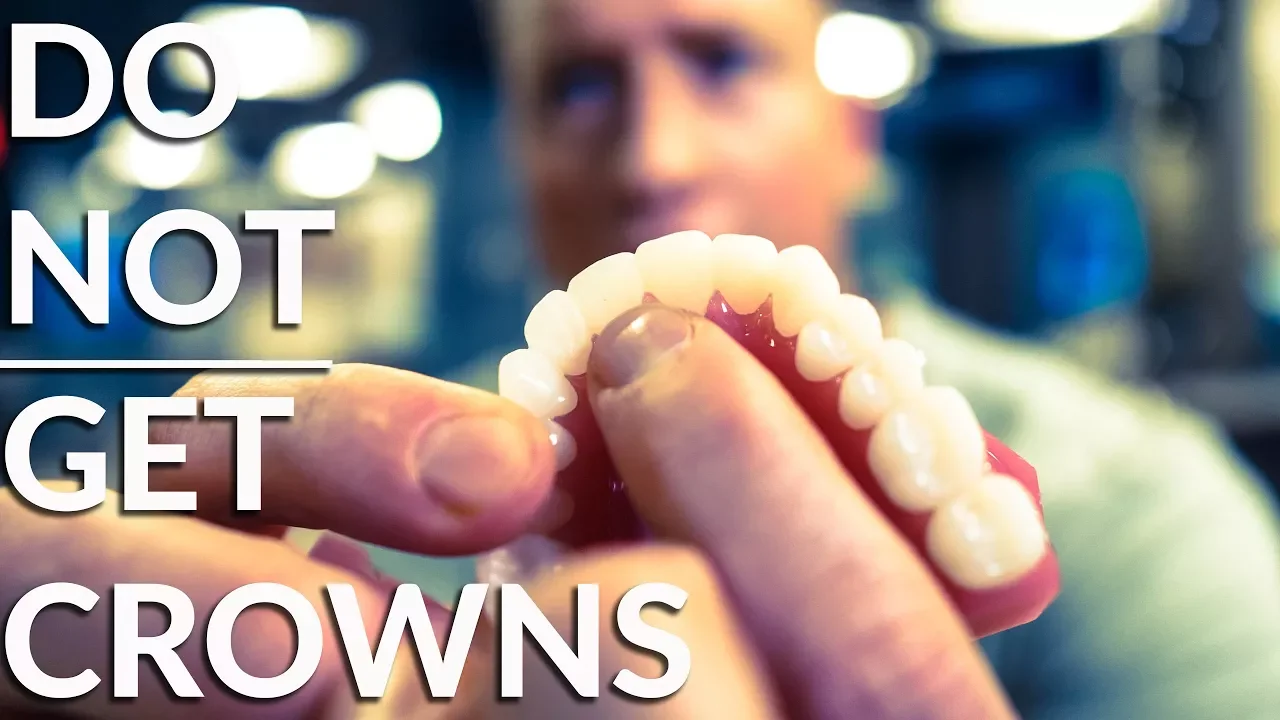 Outline Video Do NOT crown your teeth! - Must watch before dental work!