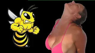 Stung By a Bee In a Special Place -S2:E50