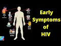 Download Lagu Wat zijn de vroege tekenen en symptomen van een hiv-infectie? - HIV/AIDS