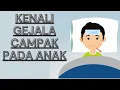 Lagu Tanda Anak Terkena Campak, Bahayakah?