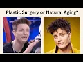 Has Matt Rife had Plastic Surgery Celebrity Facial Analysis