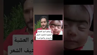 عرفتو اسم العشبة المعجزة لتكثيف الشعر والرموش والحواجب 