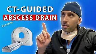 Emergent Abscess Drainage in under 30sec - Interventional Radiology