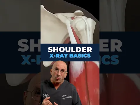 How to Read a Shoulder X-Ray in 30 Seconds (Surgeon Explains)
