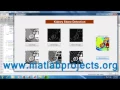 Kidney Stone Detection Image Proceesing Matlab Projects