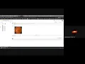 DIABITES RETINOPATHY using deep learning