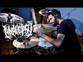 Download Lagu ANALEPSY \