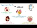Download Lagu Prolactin \u0026 Hyperprolactinemia