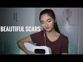 Download Lagu Beautiful Scars - Maximillian (Cover)