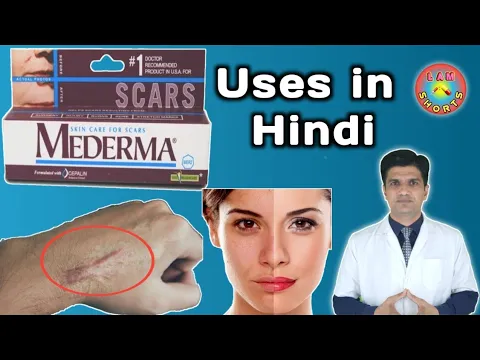 Download MP3 Mederma cream | mederma for acne scars | mederma advanced scar gel review