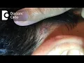Is it normal to have painful lump behind the ear - Dr Sreenivasa Murthy T M