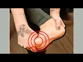Hallux Rigidus Self Treatment Big Toe Arthritis Exercises