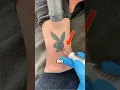 Download Lagu How Laser Tattoo Removal Is Done (@hwclinicbrugge)