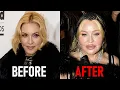 Celebrities Who COMPLETELY RUINED Their Faces With Lip Fillers