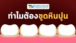  ควรตรวจสุขภาพช่องปากและขูดหินปูนบ่อยแค่ไหน 