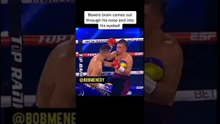 Boxers Brain Comes Out Of Nose Boxing Boxer 2021 Fighter Fight Highlight Braindamage Fyp 
