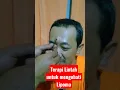 Lipoma diterapi lintah aja👍 Josss #terapilintah #lintah #therapy