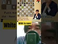 Download Lagu Utut Adianto Brilliant's #belajarcatur #catur #chess #memes #sigma #peakyblinders #catatancatur