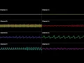 [SNES] Secret of Mana: Phantom and a Rose - Oscilloscope View