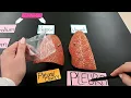 The Serous membranes - Visceral vs Parietal Serosa