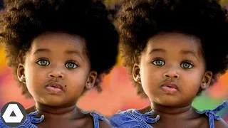 10 rarest black twins who are one in a million