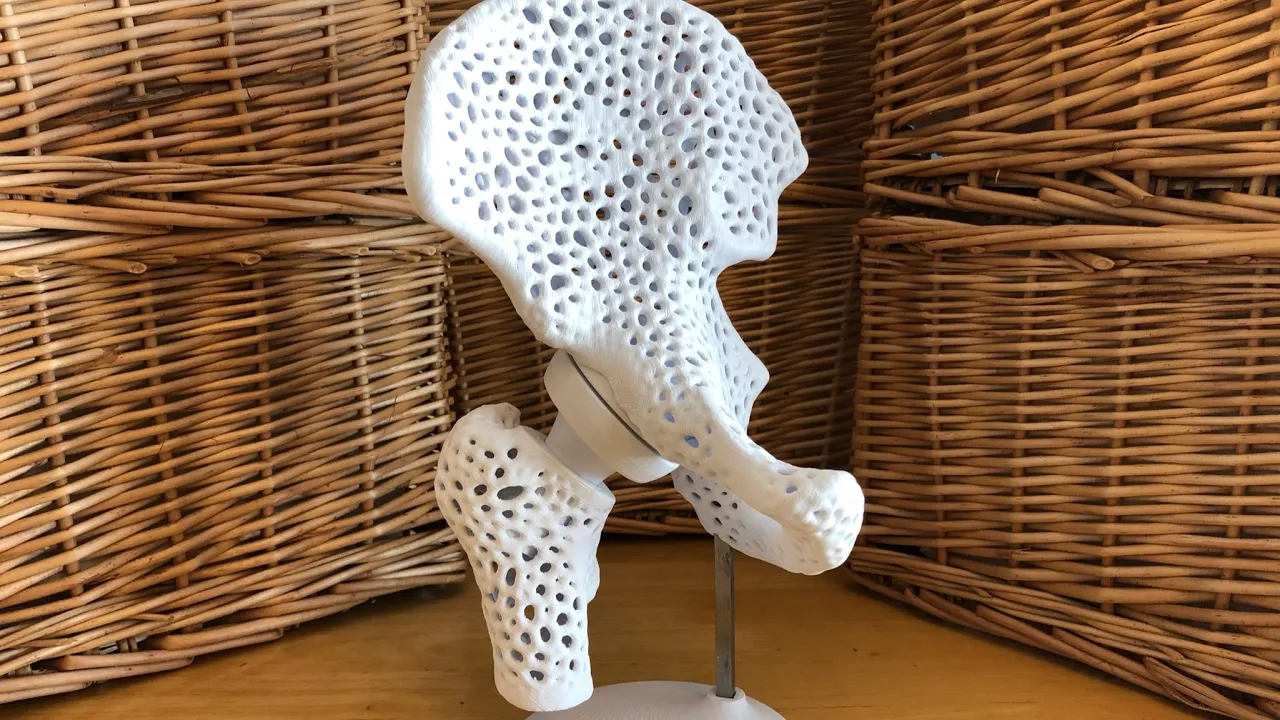 Pelvis Model with Adjustable Ball and Socket Acetabular Joint