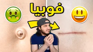 أغرب أنواع الفوبيا 👻👿😨