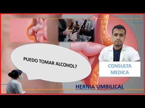 Download MP3 ¿Cuánto tiempo debo esperar para tomar alcohol después de una cirugía de hernia umbilical?