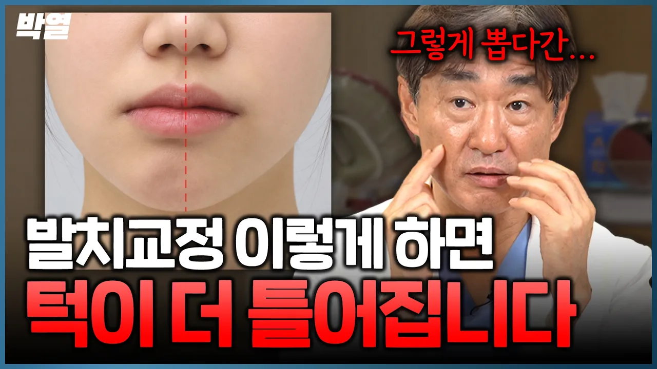 발치교정, 무조건 짝수로 뽑으면 안 되는 이유