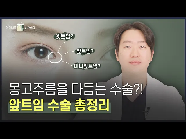 트임 하기 전 필수 시청📺 몽고 주름을 다듬는 앞 트임 수술 총.정.리!