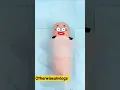 CRAZY doodle operation 😂😲 #shortvideos #doodletoons #funny #comedy #kartun #cartoon