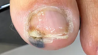 Ela bateu o dedo no Raque do carro 😢 #nails #satisfying