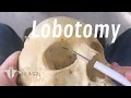Download Lagu The Anatomy of a Lobotomy
