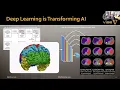 Data driven interference in diffusion MRI DL harmonization of quantitative brain biomarkers