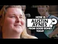 How is Austin Aynes from Good Bones now Weight Loss Health Update