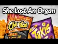 Girl Loses Organ After Eating Flamin Hot Cheetos This Is Why