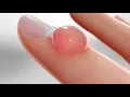 CPT code for Excision of cyst - simplify medical coding