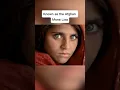 People Who Born With Extraordinary eye s