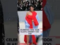 Download Lagu Celebrities Who Took Plastic Surgery Too Fa