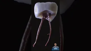 هل شاهدت من قبل شكل العصب من داخل الضرس 