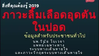 สาเหตุหลักที่ทำให้เกิดลิ่มเลือดอุดตัน มีอะไรบ้าง และทำไมการนั่งนานจึงเสี่ยง