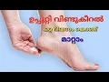Download Lagu ഉപ്പൂറ്റി വിണ്ടു കീറൽ ഒറ്റ  ദിവസം കൊണ്ട് മാറ്റാം //കാൽ വിണ്ടുകീറൽ // Home remedy for cracked heels