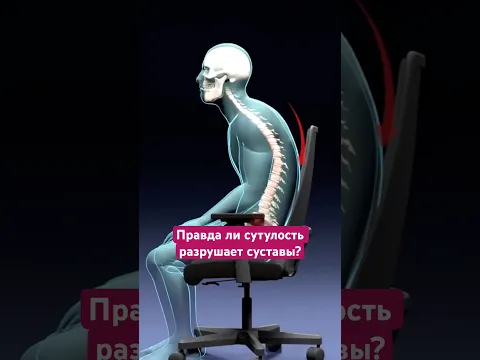 Правда ли сутулость разрушает суставы?