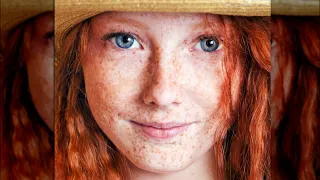 Download Why Having Blue Eyes With Red Hair Is So Rare MP3