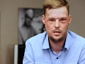 Face Transplant Links Men Touched by Tragedy